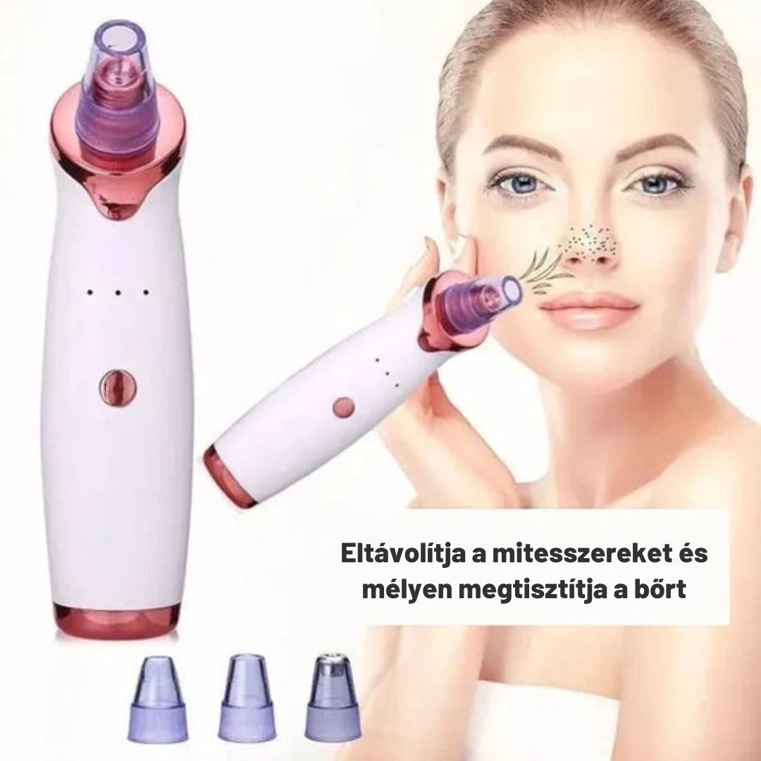 Aknéeltávolító™ – Hatékony és fájdalommentes tisztítás