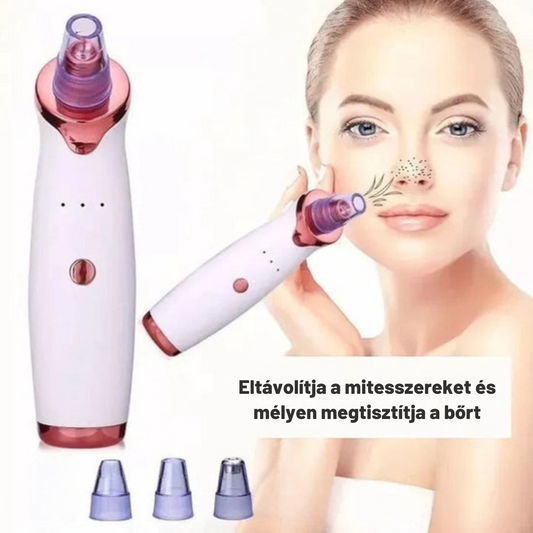 Aknéeltávolító™ – Hatékony és fájdalommentes tisztítás