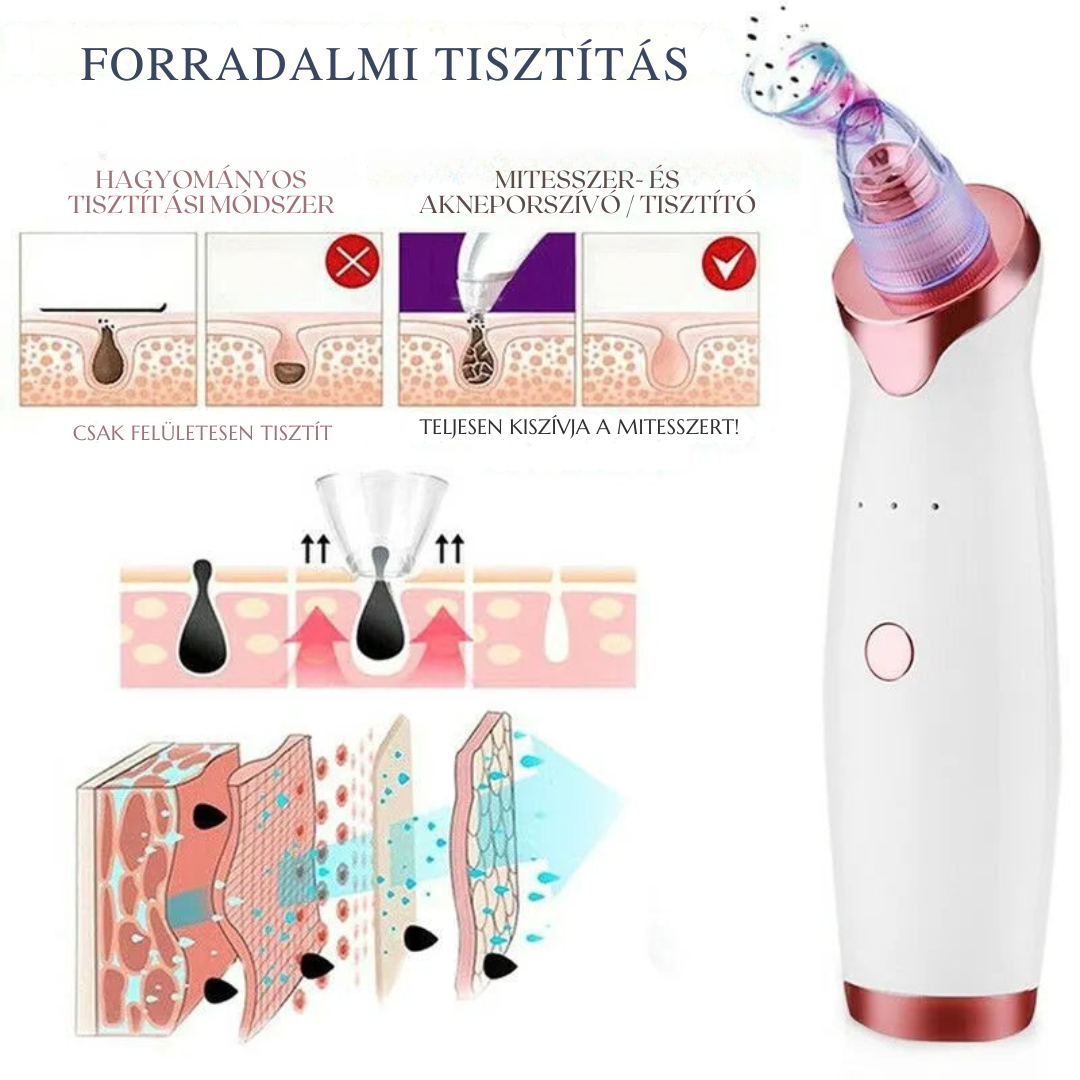 Aknéeltávolító™ – Hatékony és fájdalommentes tisztítás
