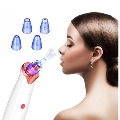 Aknéeltávolító™ – Hatékony és fájdalommentes tisztítás