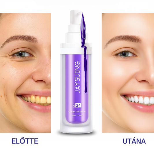 GlumiWhite™ – V34 Fehérítő – [AKCIÓ CSAK MA ÉRVÉNYES]