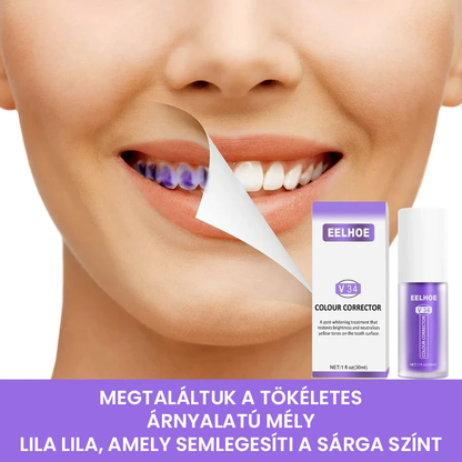 Fogszínkorrektor és zománcápoló szérum