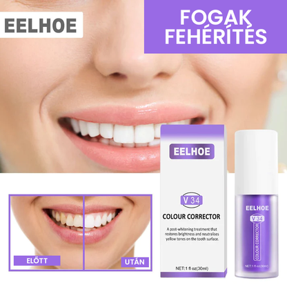 Fogszínkorrektor és zománcápoló szérum